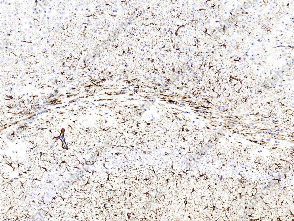 Recombinant GFAP Monoclonal Antibody - 2