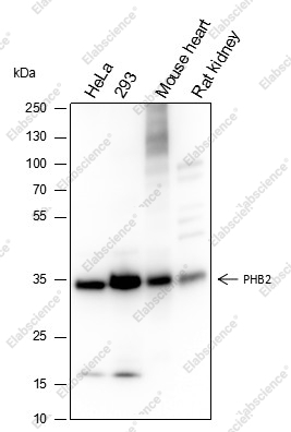 Recombinant PHB2 Monoclonal Antibody - 1