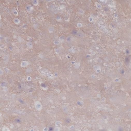 Recombinant CD47 Monoclonal Antibody - small - 4