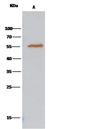 Recombinant ALDH7A1 Monoclonal Antibody - small - 1