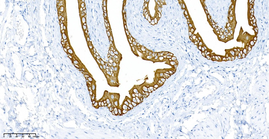 Recombinant Cytokeratin 7 Monoclonal Antibody - small - 2