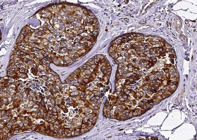 Recombinant c-Kit/CD117 Monoclonal Antibody - small - 3