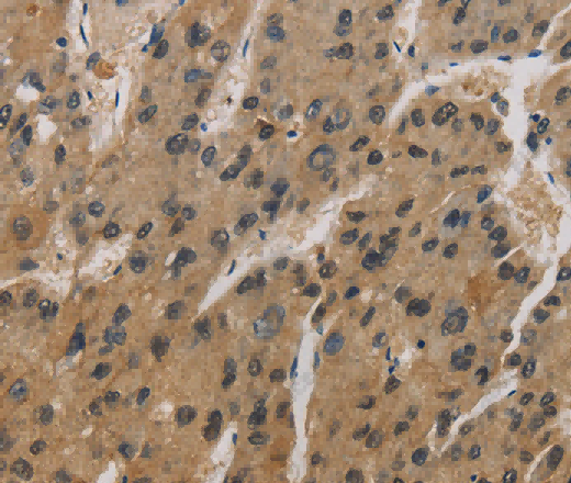CORO1C Polyclonal Antibody - 3