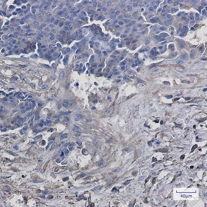 Recombinant VPS4a Monoclonal Antibody - 3