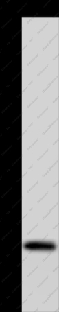 NDUFAF4 Polyclonal Antibody - 1