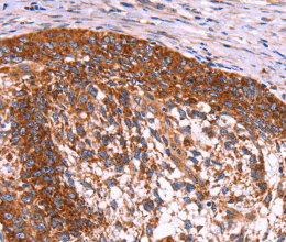 ABI1 Polyclonal Antibody - 2
