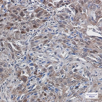 Recombinant TXNRD1 Monoclonal Antibody - 4