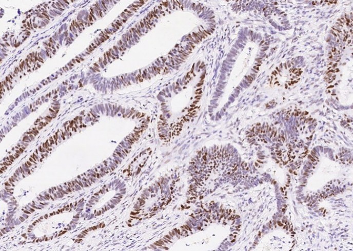 Recombinant MSH6/GTBP Monoclonal Antibody - small - 2