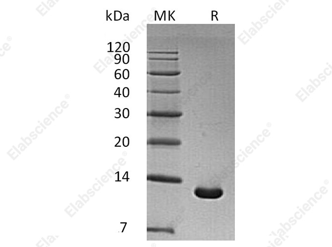 Recombinant Human S100A6 Protein (E.coli, His Tag) - 1