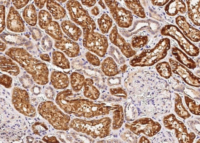 Recombinant ENTPD5 Monoclonal Antibody - small - 3