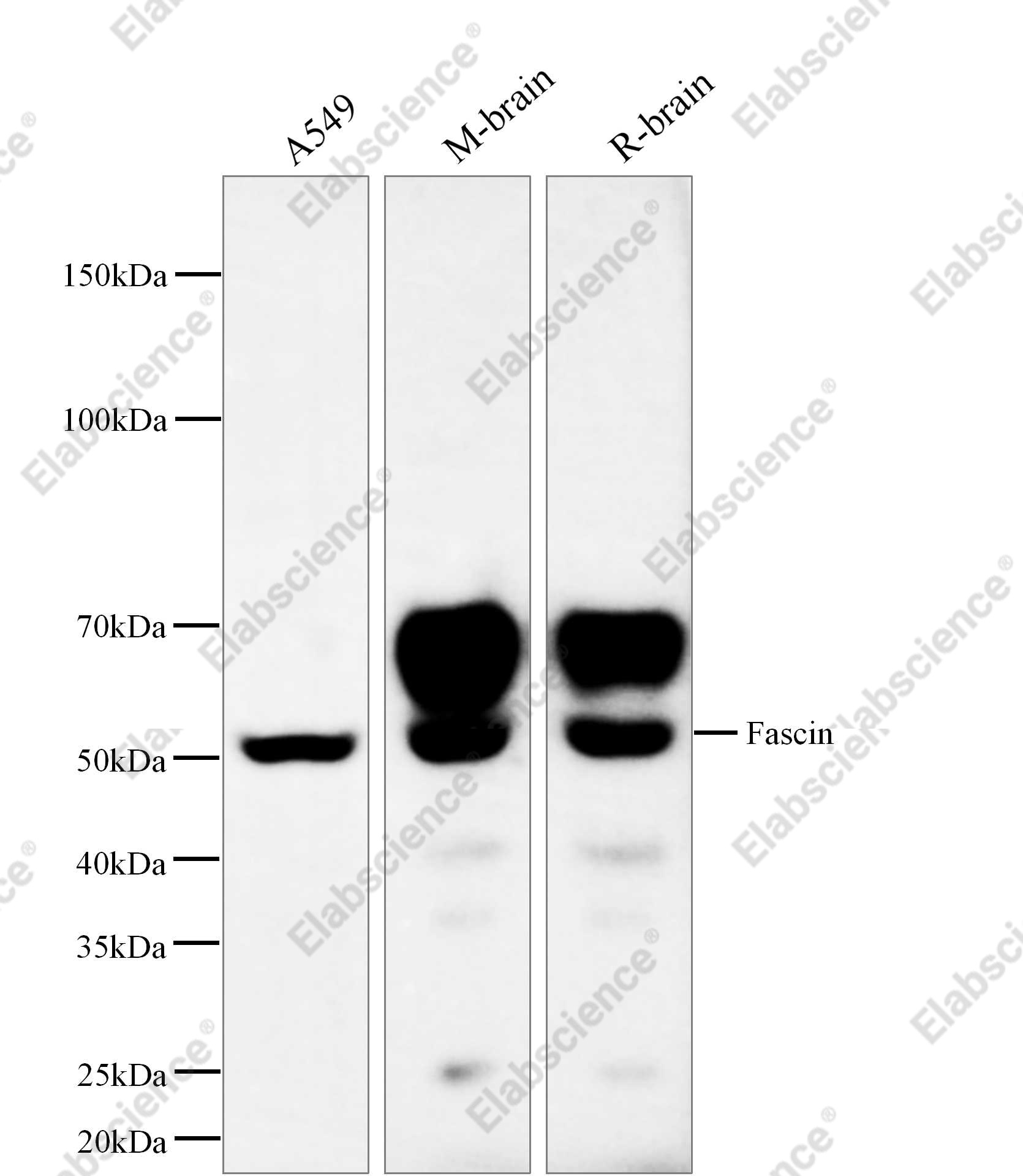 Recombinant Fascin Monoclonal Antibody - 1