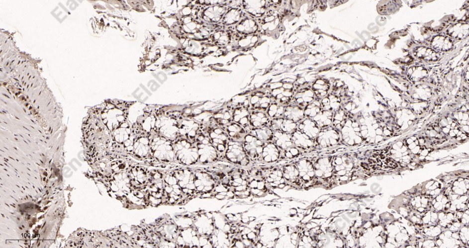 Recombinant KAP1 Monoclonal Antibody - 3
