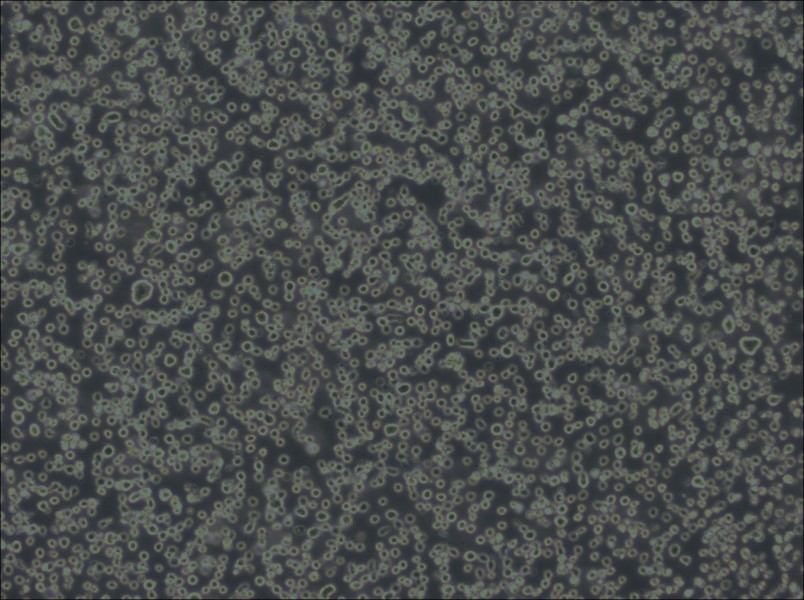 Karpas-299 Cell Complete MediumKarpas-299 Cell Complete Medium - 2