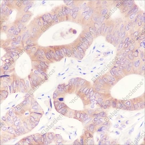 Recombinant ATG4B Monoclonal Antibody - 2