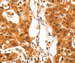 SERPINB5 Polyclonal Antibody - 3