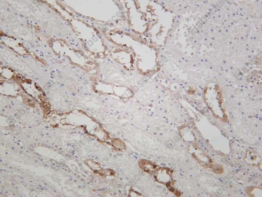 Recombinant NQO1 Monoclonal Antibody - 5