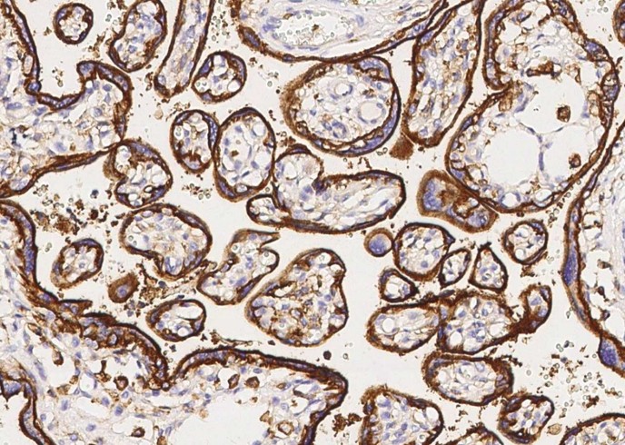 Recombinant CD98/SLC3A2 Monoclonal Antibody-searchlist-1