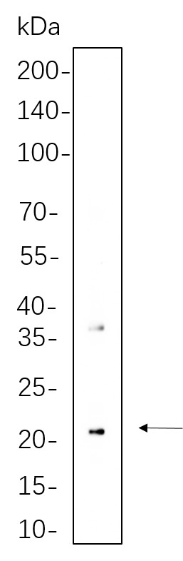 Recombinant CD90 Monoclonal Antibody-searchlist-1