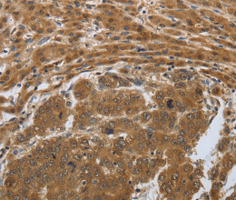 PSMD6 Polyclonal Antibody - 2