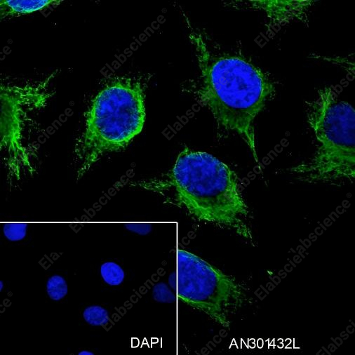 Recombinant ALOX15 Monoclonal Antibody - 3