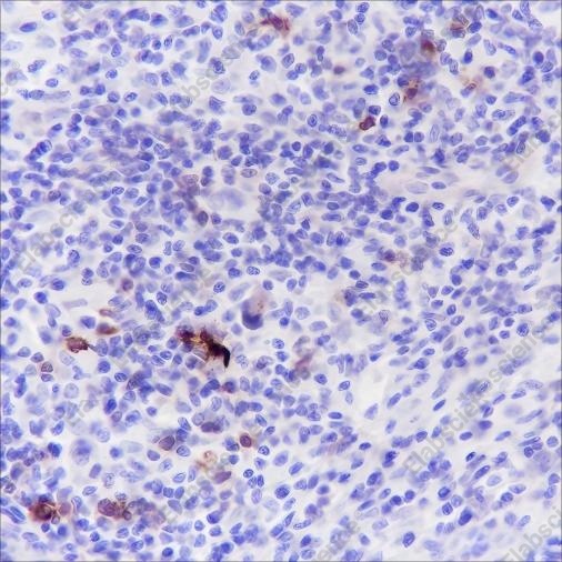 Recombinant CD134/OX40 Monoclonal Antibody - 1