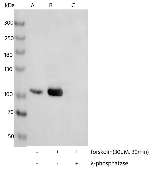 Recombinant Phospho-eEF2 (Thr56) Monoclonal Antibody - small - 3