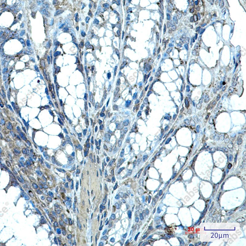 Recombinant Ihh Monoclonal Antibody - 2