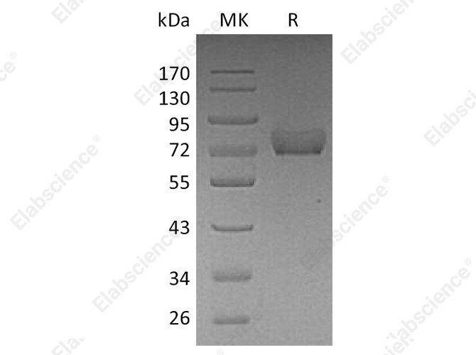 Recombinant Human Thrombomodulin/CD141 Protein (His Tag) - 1