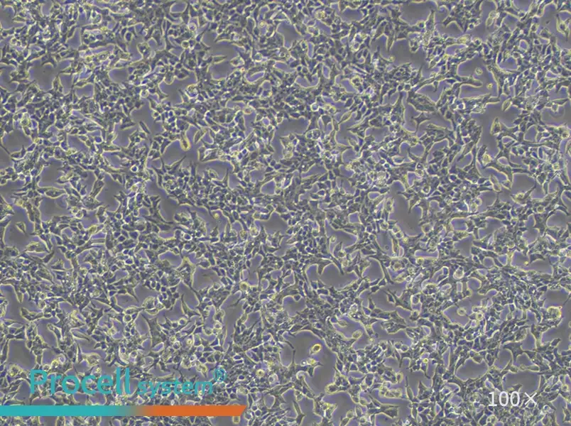 22RV1 Cell Complete Medium - 3