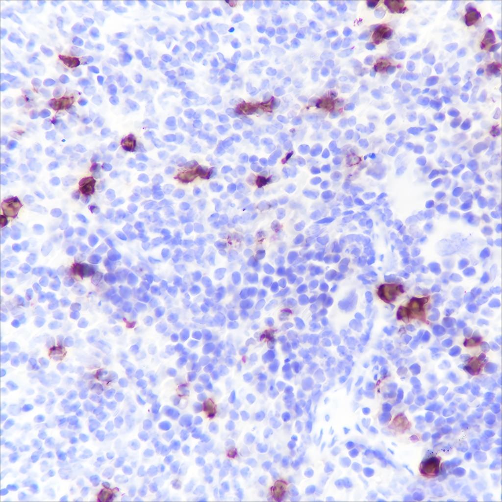 Recombinant S100A8 Monoclonal Antibody - small - 3