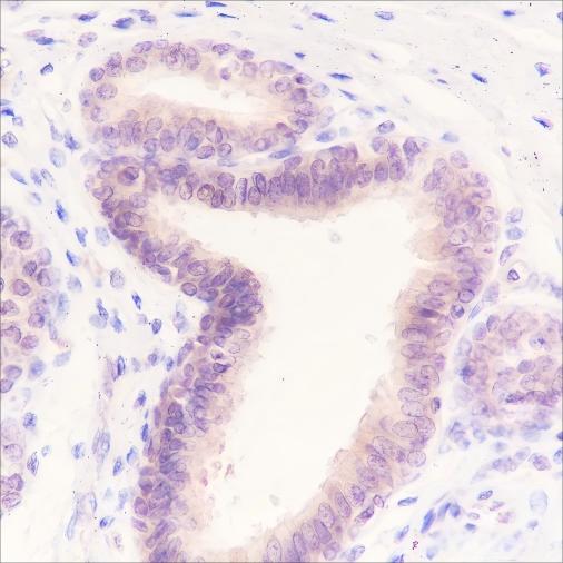 Recombinant AKT1 Monoclonal Antibody - 2