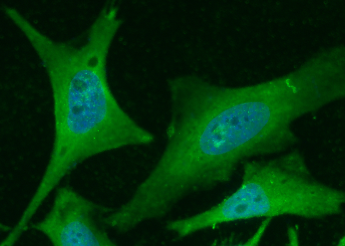 Recombinant PHPT1 Monoclonal Antibody - small - 2