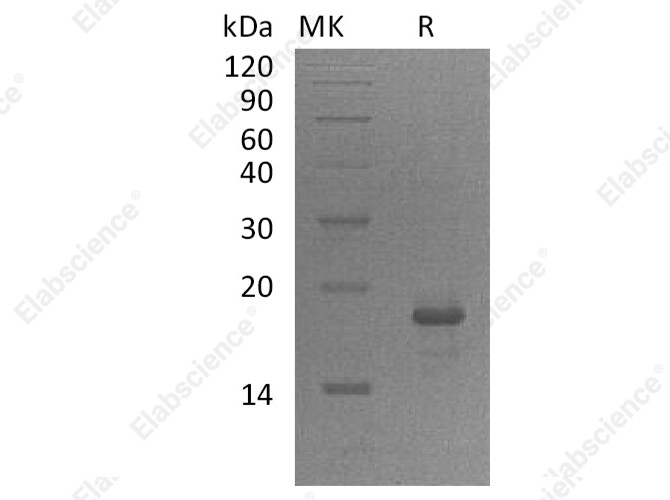 Recombinant Human GADD45A/DDIT-1 Protein (His Tag) - 1