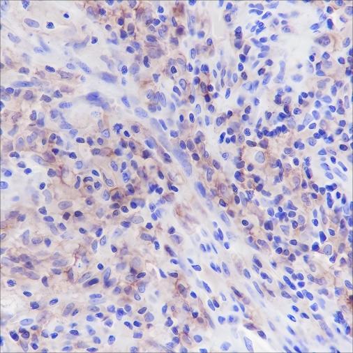 Recombinant CD33 Monoclonal Antibody-searchlist-1