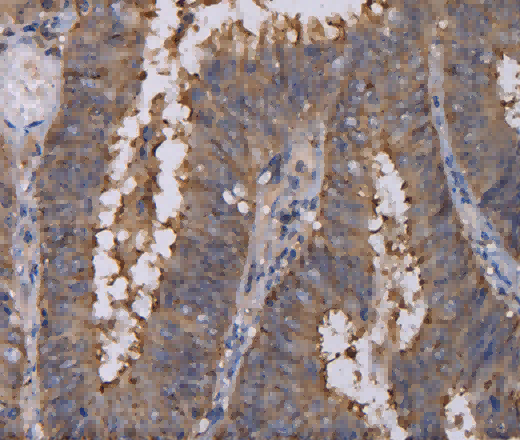 REG3G Polyclonal Antibody - 2