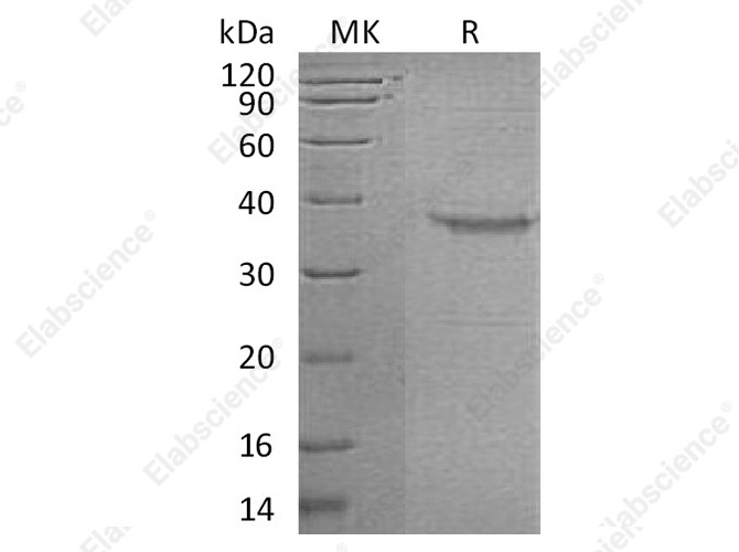 Recombinant Human Somatoliberin/GHRH Protein (Fc Tag) - 1
