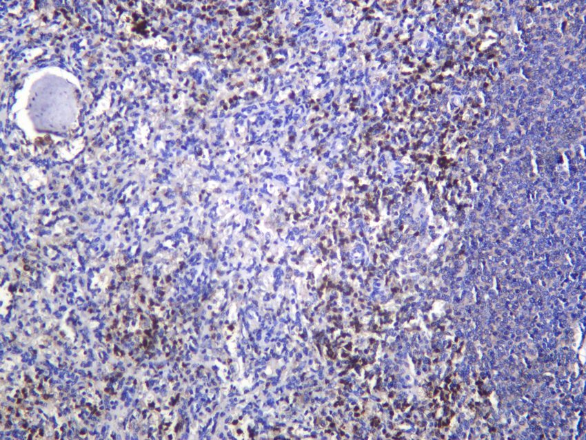Recombinant CD27/TNFRSF7 Monoclonal Antibody - 2