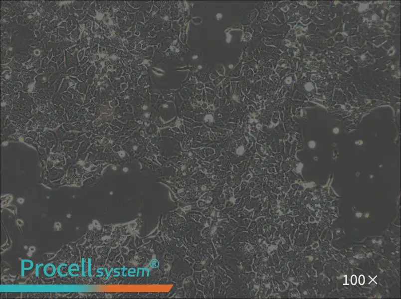 OE33 Cell Complete Medium - 1