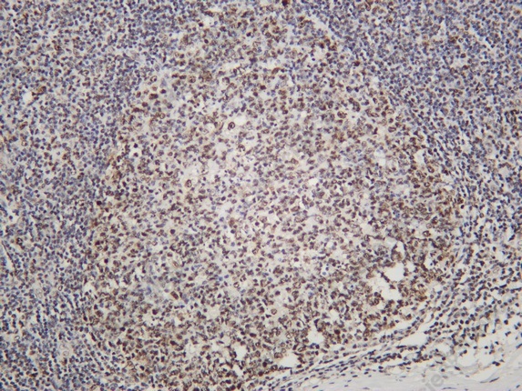 Recombinant RCC1 Monoclonal Antibody - 1