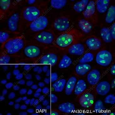 Recombinant NPM1 Monoclonal Antibody - 5