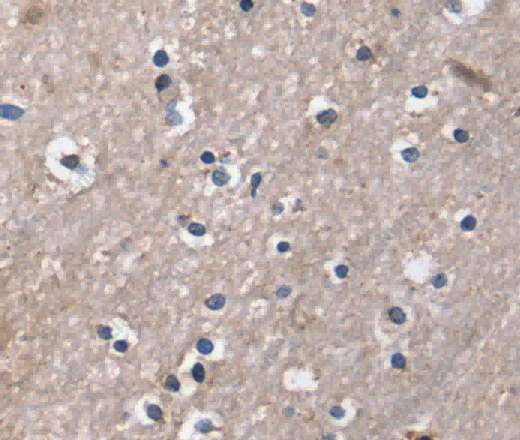 DUT Polyclonal Antibody - 2