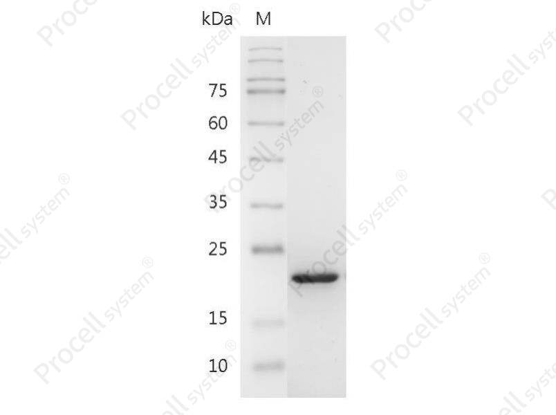 4-1BBL/TNFSF9, Human, Recombinant - 1