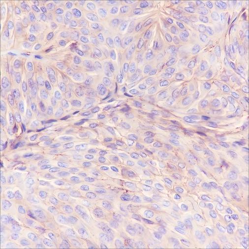 Recombinant CD59 Monoclonal Antibody - 3