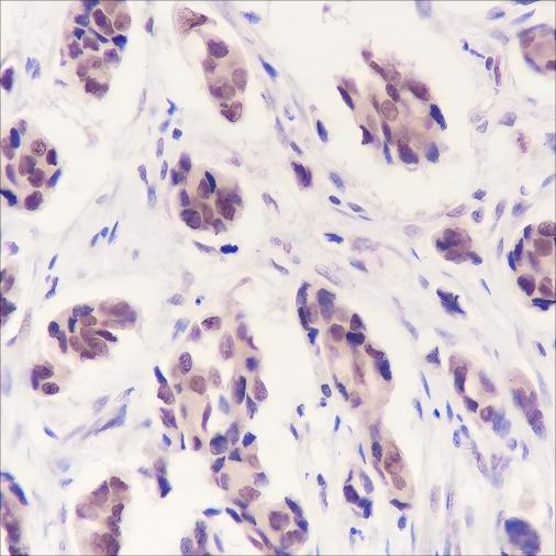 Recombinant CDK8 Monoclonal Antibody - small - 2