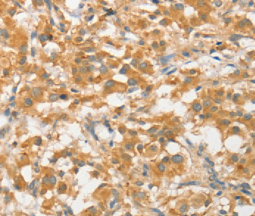 ATG5 Polyclonal Antibody - 2