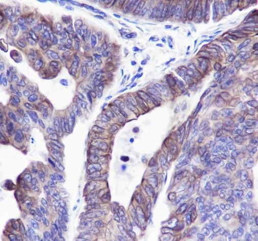 Recombinant Keratin 20 Monoclonal Antibody - 2