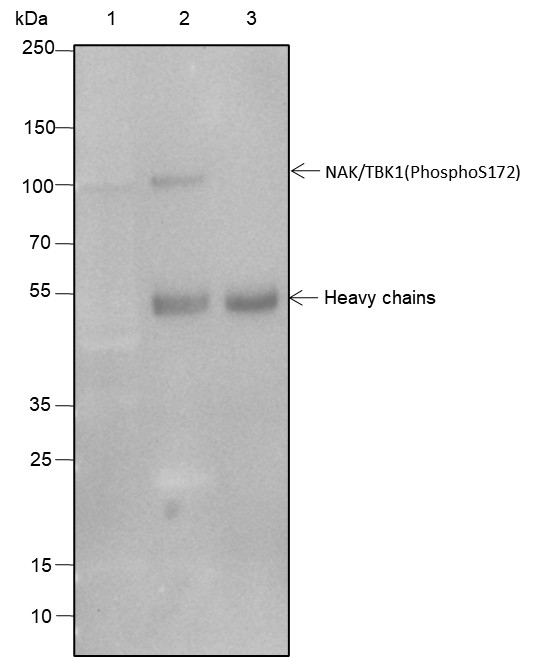 Recombinant Phospho-TBK1/NAK (Ser172) Monoclonal Antibody - small - 3