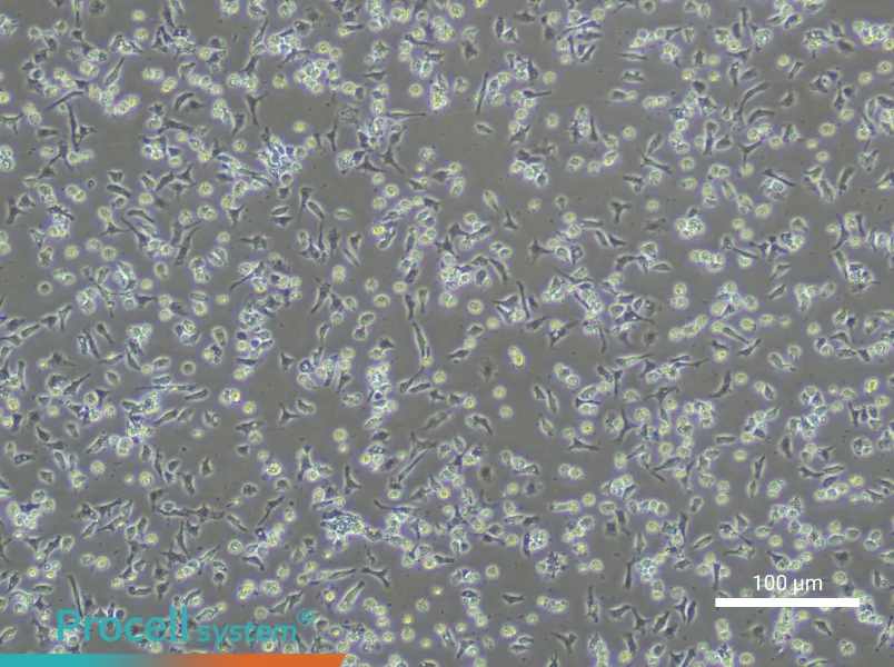 Mouse Peripheral Blood Monocyte Complete Medium - 1