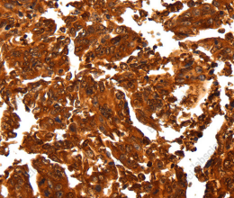 ALDOA Polyclonal Antibody - 3