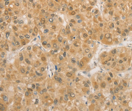 PGK2 Polyclonal Antibody - 3